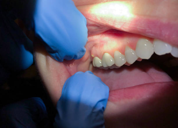 Best Emergency TMJ Treatment in Bridgeport, WA