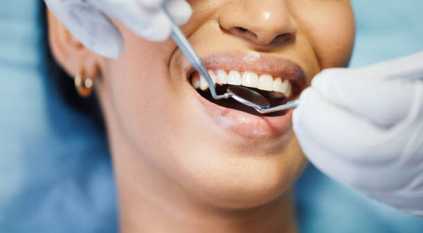 Best Emergency Treatment for Dental Infections or Abscesses in Bridgeport, WA